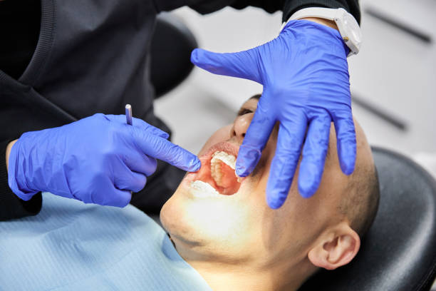 Best Broken or Chipped Tooth Repair in San Angelo, TX